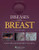 Diseases of the Breast 5e