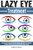 Lazy Eye Treatment: Discover How to Treat and Cure Your Lazy Eye (Amblyopia or Strabismus), Including At-Home Exercises and Information about Surgery