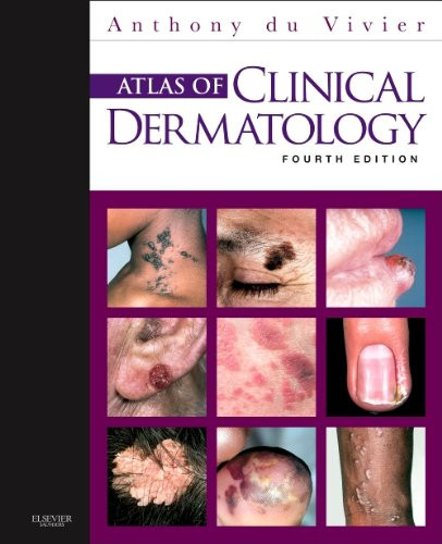 Atlas of Clinical Dermatology, 4e (du Vivier, Atlas of Clinical Dermatology)