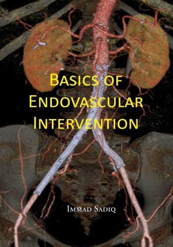 Basics of Endovascular Intervention