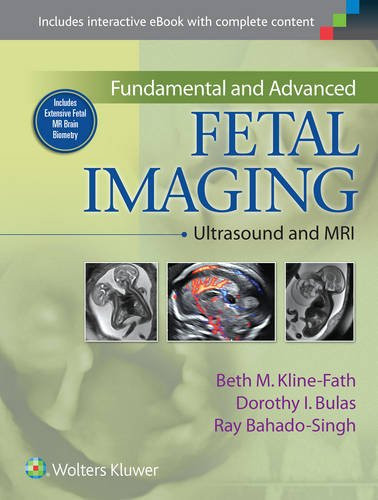 Fundamental and Advanced Fetal Imaging: Ultrasound and MRI