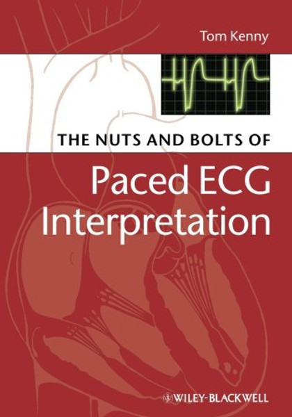 The Nuts and bolts of Paced ECG Interpretation The Nuts and bolts of Paced ECG Interpretation