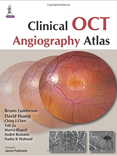 Clinical OCT Angiography Atlas