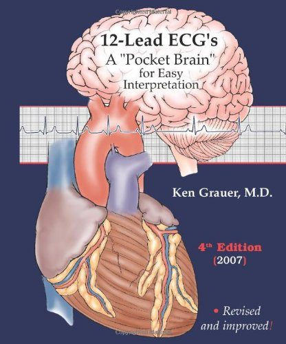 ECG Pocket Guide (Pocket Brain) - ECG Interpretation