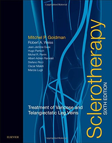 Sclerotherapy: Treatment of Varicose and Telangiectatic Leg Veins, 6e