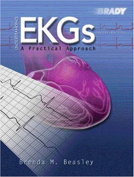 Understanding EKGs: A Practical Approach (2nd Edition)
