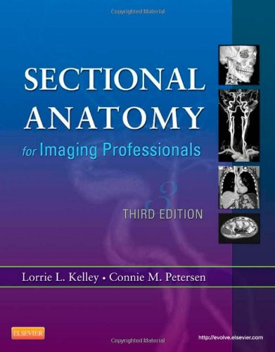 Sectional Anatomy for Imaging Professionals, 3e