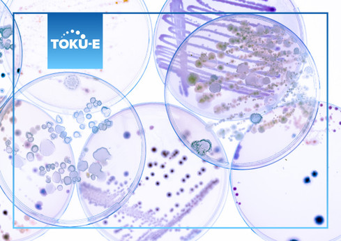 What is Antimicrobial Susceptibility Testing (AST) and why is it important?