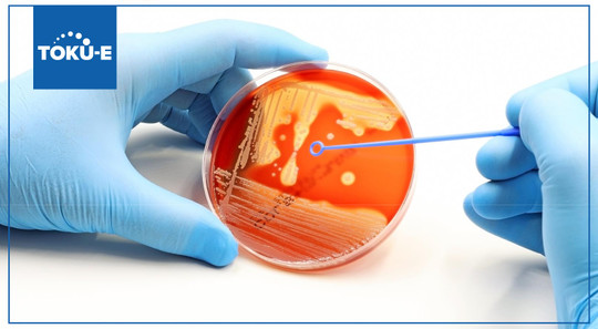 Help mitigate antimicrobial resistance with susceptibility testing