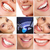 HiWhite Smile Teeth Whitening Kit