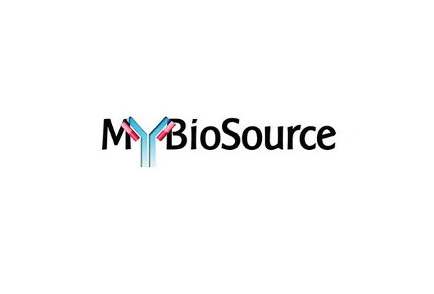 Myomesin 2 (MYOM2) Antibody Pair Kit (with Standard)