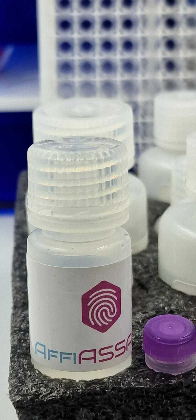 Acetate Elisa Kits & Antibodies