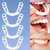"Invisible Teeth Aligners - Soft Silicone Orthodontic Mouthguards with Storage Case"