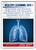 Education and Training to Balance the Treatment and Management of Patients Diagnosed with COPD