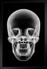 Human Skull Xray Black Wood Framed Art Poster 14x20