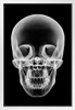 Human Skull Xray White Wood Framed Poster 14x20