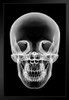 Human Skull Xray Art Print Stand or Hang Wood Frame Display Poster Print 9x13