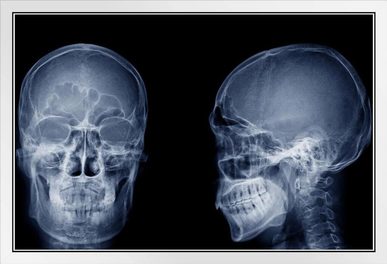 head x ray pictures