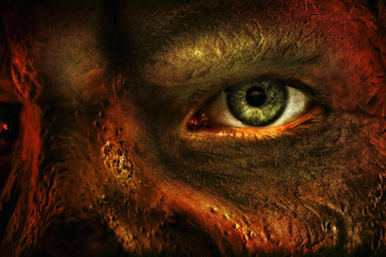 Laminated Close Up of Mans Eye and Burned Skin Horrific Photo Photograph Poster Dry Erase Sign 36x24