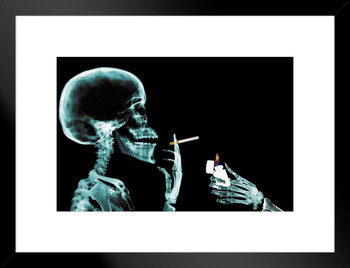 Skeleton Getting Cigarette Lit X Ray Photo Matted Framed Art Print Wall Decor 26x20 inch