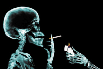 Laminated Skeleton Getting Cigarette Lit X Ray Photo Art Print Poster Dry Erase Sign 18x12