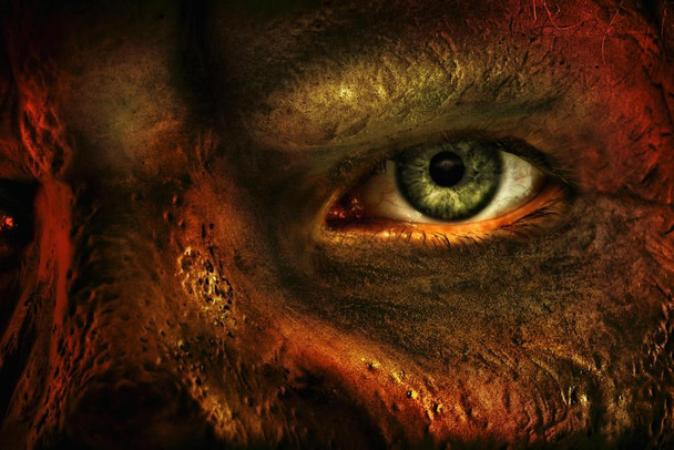 Close Up of Mans Eye and Burned Skin Horrific Photo Photograph Cool Wall Decor Art Print Poster 36x24