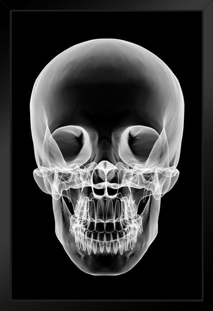 Human Skull Xray Art Print Stand or Hang Wood Frame Display Poster Print 9x13