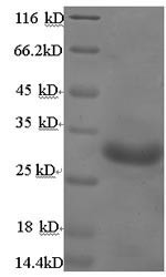(Tris-Glycine gel) Discontinuous SDS-PAGE (reduced) with 5% enrichment gel and 15% separation gel.