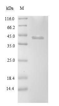 (Tris-Glycine gel) Discontinuous SDS-PAGE (reduced) with 5% enrichment gel and 15% separation gel.