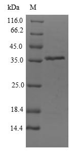 (Tris-Glycine gel) Discontinuous SDS-PAGE (reduced) with 5% enrichment gel and 15% separation gel.
