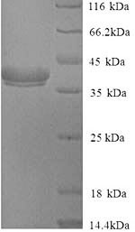 (Tris-Glycine gel) Discontinuous SDS-PAGE (reduced) with 5% enrichment gel and 15% separation gel.