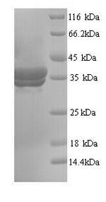 (Tris-Glycine gel) Discontinuous SDS-PAGE (reduced) with 5% enrichment gel and 15% separation gel.