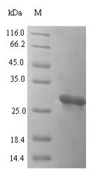 (Tris-Glycine gel) Discontinuous SDS-PAGE (reduced) with 5% enrichment gel and 15% separation gel.