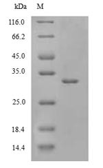 (Tris-Glycine gel) Discontinuous SDS-PAGE (reduced) with 5% enrichment gel and 15% separation gel.