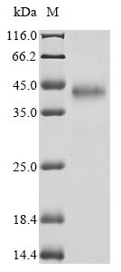 (Tris-Glycine gel) Discontinuous SDS-PAGE (reduced) with 5% enrichment gel and 15% separation gel.