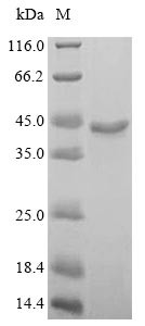 (Tris-Glycine gel) Discontinuous SDS-PAGE (reduced) with 5% enrichment gel and 15% separation gel.