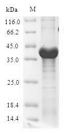 (Tris-Glycine gel) Discontinuous SDS-PAGE (reduced) with 5% enrichment gel and 15% separation gel.