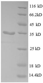 (Tris-Glycine gel) Discontinuous SDS-PAGE (reduced) with 5% enrichment gel and 15% separation gel.