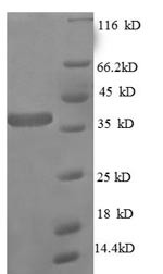 (Tris-Glycine gel) Discontinuous SDS-PAGE (reduced) with 5% enrichment gel and 15% separation gel.