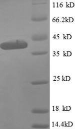 (Tris-Glycine gel) Discontinuous SDS-PAGE (reduced) with 5% enrichment gel and 15% separation gel.