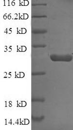 (Tris-Glycine gel) Discontinuous SDS-PAGE (reduced) with 5% enrichment gel and 15% separation gel.