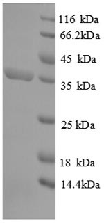 (Tris-Glycine gel) Discontinuous SDS-PAGE (reduced) with 5% enrichment gel and 15% separation gel.