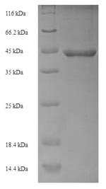 (Tris-Glycine gel) Discontinuous SDS-PAGE (reduced) with 5% enrichment gel and 15% separation gel.