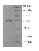 (Tris-Glycine gel) Discontinuous SDS-PAGE (reduced) with 5% enrichment gel and 15% separation gel.