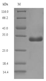 (Tris-Glycine gel) Discontinuous SDS-PAGE (reduced) with 5% enrichment gel and 15% separation gel.