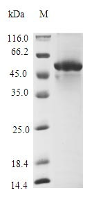 (Tris-Glycine gel) Discontinuous SDS-PAGE (reduced) with 5% enrichment gel and 15% separation gel.