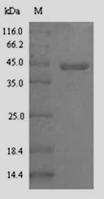 (Tris-Glycine gel) Discontinuous SDS-PAGE (reduced) with 5% enrichment gel and 15% separation gel.