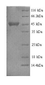 (Tris-Glycine gel) Discontinuous SDS-PAGE (reduced) with 5% enrichment gel and 15% separation gel.