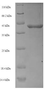 (Tris-Glycine gel) Discontinuous SDS-PAGE (reduced) with 5% enrichment gel and 15% separation gel.