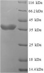 (Tris-Glycine gel) Discontinuous SDS-PAGE (reduced) with 5% enrichment gel and 15% separation gel.
